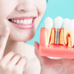 Innovative Dental Implants for Confident, Healthy Smiles