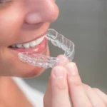Techniques for Wearing Retainers Effectively