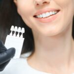 The Benefits of Veneers