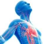 What Is Angina?